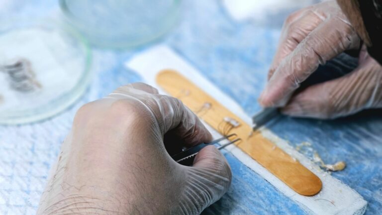 Bioimpresión de Folículos Pilosos: Revolucionando los Injertos Capilares Sintéticos
