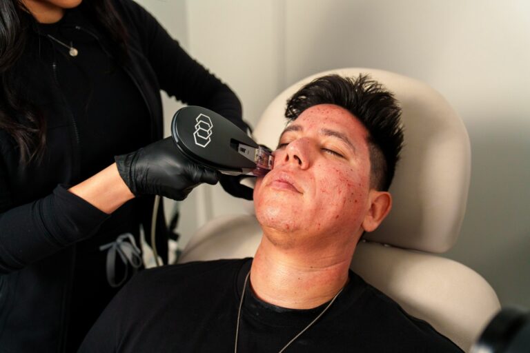 Tratamientos Faciales Antiedad para Hombres: Guía Completa de Opciones No Invasivas